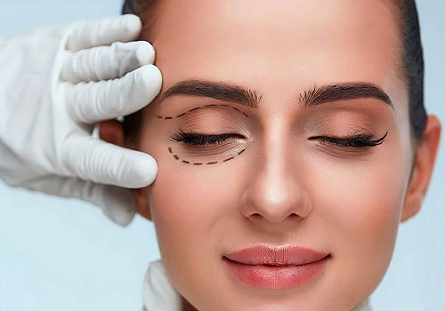 Cirugía de Oculoplástica